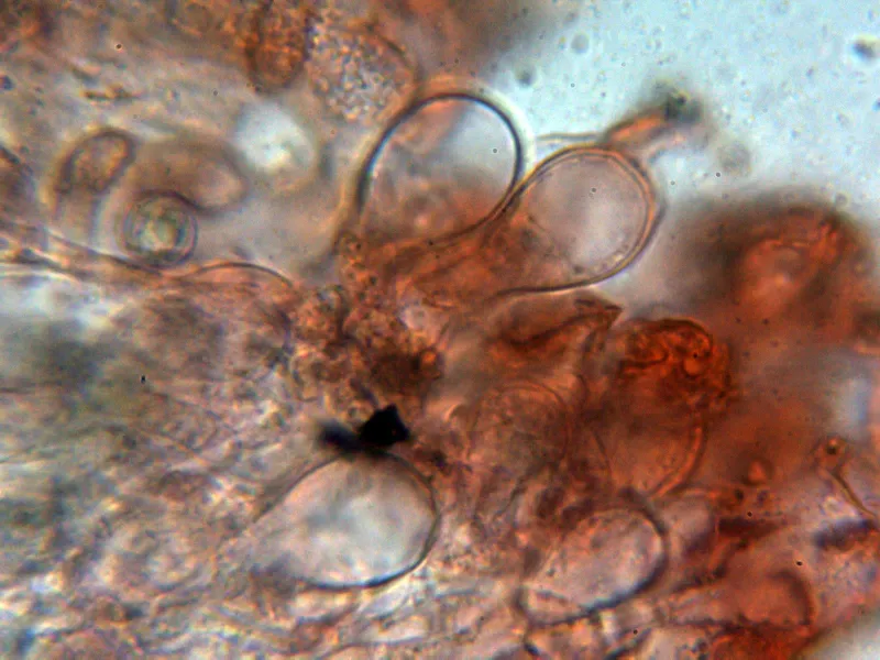 Amanita crocea 10 - Queilocistidios 4
